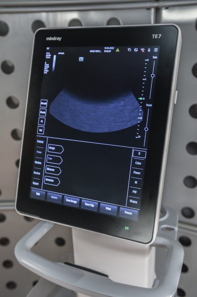 Mindray TE7 Diagnostic Ultrasound System w/ Rolling Cart Pinnacle