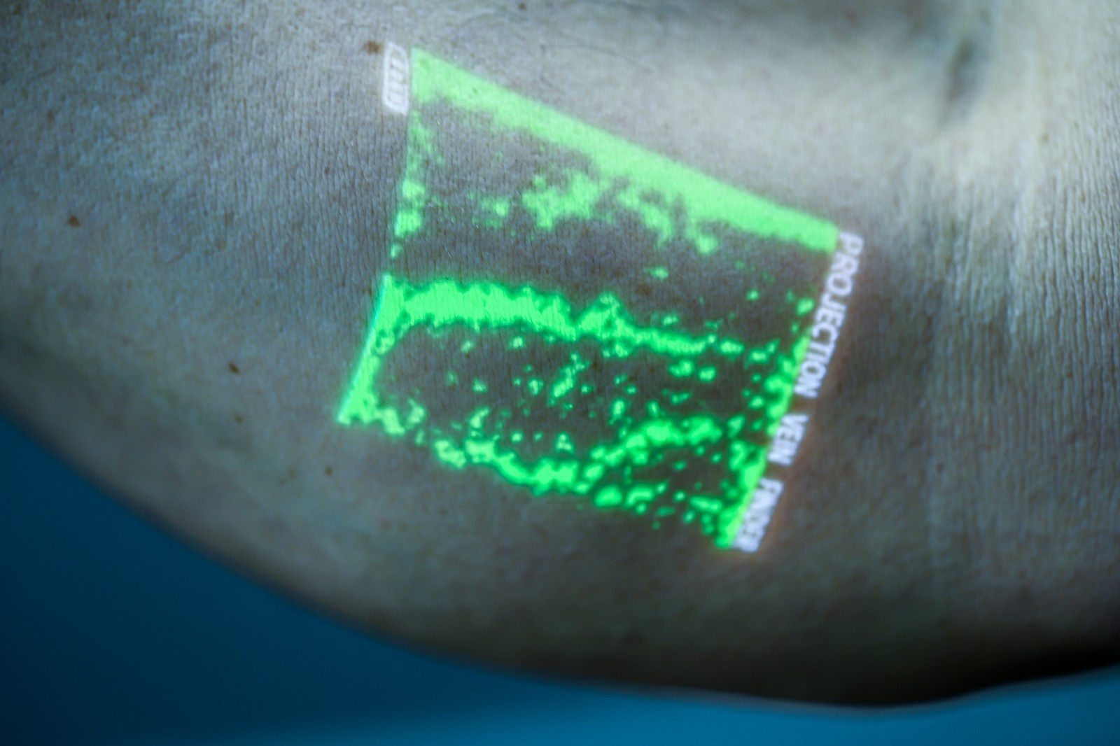 Nextvein Model V800NV Handheld Vein Finder System w/Extended Reach Wheeled Stand - Image 6